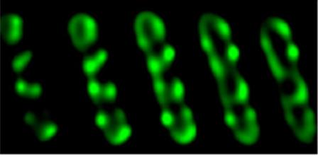 Optical sections, bacterial cell where each T4SS is green
